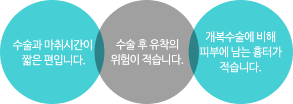 수술과 마취시간이 짧은 편입니다./수술 후 유착의 위험이 적습니다./개복수술에 비해 피부에 남는 흉터가 적습니다.